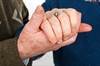 Is Depression A Risk Factor Or a Prodromal Symptom of Dementia? Is Depression A Risk Factor Or a Prodromal Symptom of Dementia?