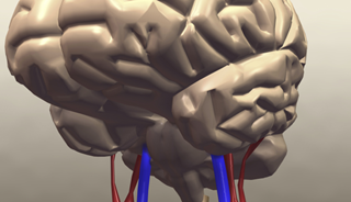 Stress and Depression Can Lead to Increased Stroke Risk Stress and Depression Can Lead to Increased Stroke Risk
