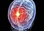 Even Mild TBI May Cause Brain Damage Even Mild TBI May Cause Brain Damage