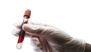 Blood Test Developed to Detect Parkinson's Early Blood Test Developed to Detect Parkinson's Early