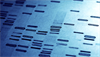 Biomarkers For Early Alzheimer's Disease Detection Biomarkers For Early Alzheimer's Disease Detection