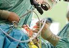 Stress as Predictor of Postoperative Pain Stress as Predictor of Postoperative Pain