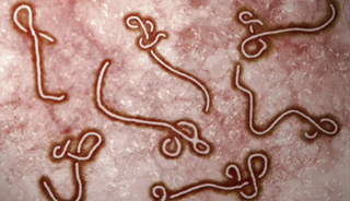 The Ebola Outbreak and Mental Health The Ebola Outbreak and Mental Health