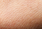 Skin Test Could Help Diagnose Alzheimer's, Parkinson's Skin Test Could Help Diagnose Alzheimer's, Parkinson's