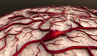 Alzheimer's Disease May Have Roots in Vascular System Alzheimer's Disease May Have Roots in Vascular System