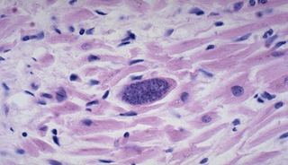 Targeting Common Parasite Could Help Treat Certain Mental Disorders Targeting Common Parasite Could Help Treat Certain Mental Disorders
