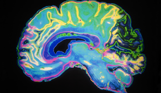 How Neuroinflammation May Play a Role in Mood Disorders How Neuroinflammation May Play a Role in Mood Disorders