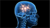 How Diabetes Can Damage the Brain How Diabetes Can Damage the Brain