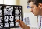 Ocrelizumab Promotes No Evidence of Disease Activity in Multiple Sclerosis Ocrelizumab Promotes No Evidence of Disease Activity in Multiple Sclerosis