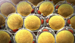 Fat Build-Up in Brain May Accelerate Alzheimer's Fat Build-Up in Brain May Accelerate Alzheimer's