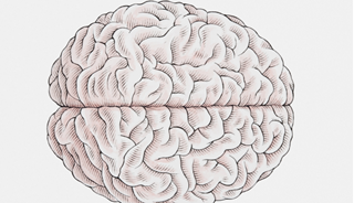 Length of Brain Fold Tied to Hallucinations in Schizophrenia Length of Brain Fold Tied to Hallucinations in Schizophrenia