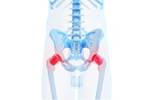 Radiographs not reliable for detecting hip osteoarthritis Radiographs not reliable for detecting hip osteoarthritis
