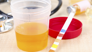 The findings suggest that it may be possible to develop a non-invasive tool for early diagnosis of Alzheimer's disease. The findings suggest that it may be possible to develop a non-invasive tool for early diagnosis of Alzheimer's disease.