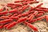 Gut Microbiota May Play a Role in Progression of Parkinson's Disease Gut Microbiota May Play a Role in Progression of Parkinson's Disease