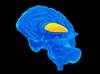 Depression May Accelerate Brain Aging Depression May Accelerate Brain Aging
