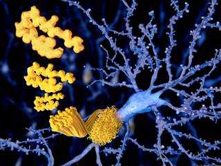 The cumulative effect of vascular risk factors had the most significant impact on development of amyloid plaques. The cumulative effect of vascular risk factors had the most significant impact on development of amyloid plaques.