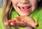 ASD Linked to Prenatal Metal Exposure According to Baby Teeth Findings ASD Linked to Prenatal Metal Exposure According to Baby Teeth Findings