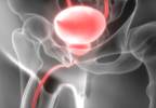 Urinary Incontinence in Women: Screening Guidelines and Recommendations Urinary Incontinence in Women: Screening Guidelines and Recommendations