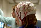 Neuropsychiatric Outcomes in Childhood Epilepsy Predicted by Seizure Frequency Neuropsychiatric Outcomes in Childhood Epilepsy Predicted by Seizure Frequency