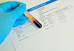 Nonoptimal Serum Magnesium Levels Associated With Incident Dementia Nonoptimal Serum Magnesium Levels Associated With Incident Dementia