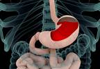 Dementia Risk Not Associated With Proton Pump Inhibitor Use Dementia Risk Not Associated With Proton Pump Inhibitor Use