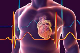 Evidence has shown that patients with ACS are at risk for a number of negative mental health consequences, including depression and major depressive disorder. Evidence has shown that patients with ACS are at risk for a number of negative mental health consequences, including depression and major depressive disorder.