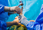 Psychosis Associated With Increased Complications Following Total Joint Arthroplasty Psychosis Associated With Increased Complications Following Total Joint Arthroplasty