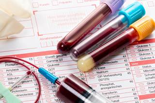 The FNIH Biomarkers Consortium has announced a new initiative to identify inflammatory biomarkers for the early detection and subtyping of neurodegenerative and mood disorders. The FNIH Biomarkers Consortium has announced a new initiative to identify inflammatory biomarkers for the early detection and subtyping of neurodegenerative and mood disorders.