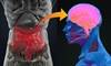 The Way to the Head May Be Through the Gut: Probiotics for Depression The Way to the Head May Be Through the Gut: Probiotics for Depression