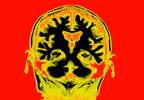 Electrical Stimulation of Amygdala May Improve Long-term Memory Electrical Stimulation of Amygdala May Improve Long-term Memory