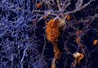 Clinicians With Alzheimer Disease: Reframing Perceptions Clinicians With Alzheimer Disease: Reframing Perceptions