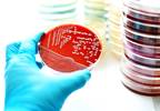 Infection in First Year Has Greatest Effect on IQ, Nonaffective Psychosis Infection in First Year Has Greatest Effect on IQ, Nonaffective Psychosis