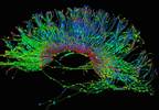 Greater Neural Connectivity Provides Resilience to Major Depressive Disorder Greater Neural Connectivity Provides Resilience to Major Depressive Disorder
