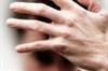 Adjuvant Sodium Benzoate Improves Symptoms of Clozapine-Resistant Schizophrenia Adjuvant Sodium Benzoate Improves Symptoms of Clozapine-Resistant Schizophrenia