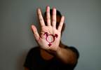 Youth With Gender Nonconformity Vulnerable to Adversity Youth With Gender Nonconformity Vulnerable to Adversity