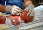 Prenatal Exposure to Opiates, Illicit Substances Associated With ADHD, Autism in Offspring Prenatal Exposure to Opiates, Illicit Substances Associated With ADHD, Autism in Offspring