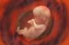 Dolutegravir Use During Pregnancy: What Are the Risks? Dolutegravir Use During Pregnancy: What Are the Risks?