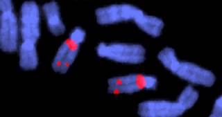 DiGeorge syndrome; deletion in chromosome 22. The chromosomes are fluorescent with probes that bind to specific sequences of DNA. <i>Credit: Wellcome Images/Science Source</i> DiGeorge syndrome; deletion in chromosome 22. The chromosomes are fluorescent with probes that bind to specific sequences of DNA. <i>Credit: Wellcome Images/Science Source</i>