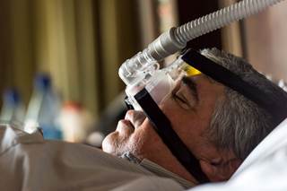 Obstructive sleep apnea is associated with changes to the structure of the brain that are seen in the early stages of dementia. Obstructive sleep apnea is associated with changes to the structure of the brain that are seen in the early stages of dementia.