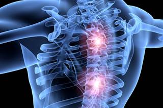 Opioid dependence is more likely to occur in patients with degenerative spondylolisthesis before surgery than afterward. Opioid dependence is more likely to occur in patients with degenerative spondylolisthesis before surgery than afterward.