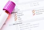 Cortisol Levels May Contribute to Global Cognitive Decline in Elderly Adults With Depression Cortisol Levels May Contribute to Global Cognitive Decline in Elderly Adults With Depression