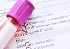 Associations Between Hypovitaminosis D and Poorer Outcomes in Schizophrenia Associations Between Hypovitaminosis D and Poorer Outcomes in Schizophrenia