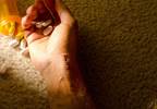 Risk Factors for Recurrent Suicide Attempts in Substance Use Disorder Outpatients Risk Factors for Recurrent Suicide Attempts in Substance Use Disorder Outpatients