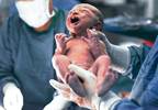 Cesarean Delivery, Early Childhood Antibiotic Use Not Associated With Risk for ADHD Cesarean Delivery, Early Childhood Antibiotic Use Not Associated With Risk for ADHD