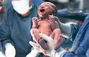 Cesarean Delivery, Early Childhood Antibiotic Use Not Associated With Risk for ADHD Cesarean Delivery, Early Childhood Antibiotic Use Not Associated With Risk for ADHD