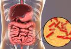 Probiotics, Depression, and the Role of Inflammation Probiotics, Depression, and the Role of Inflammation