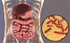 Probiotics, Depression, and the Role of Inflammation Probiotics, Depression, and the Role of Inflammation