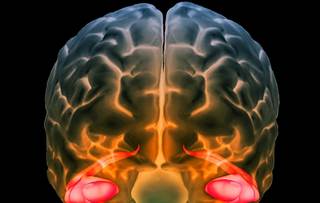 Inflammation appears to be associated with reductions in hippocampal and gray matter volumes in older patients with bipolar I disorder. <i>Credit: ISM / SOVEREIGN - ISM</i> Inflammation appears to be associated with reductions in hippocampal and gray matter volumes in older patients with bipolar I disorder. <i>Credit: ISM / SOVEREIGN - ISM</i>
