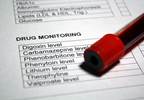 Suboptimal Serum Lithium Level Monitoring Observed in Older Adults Suboptimal Serum Lithium Level Monitoring Observed in Older Adults